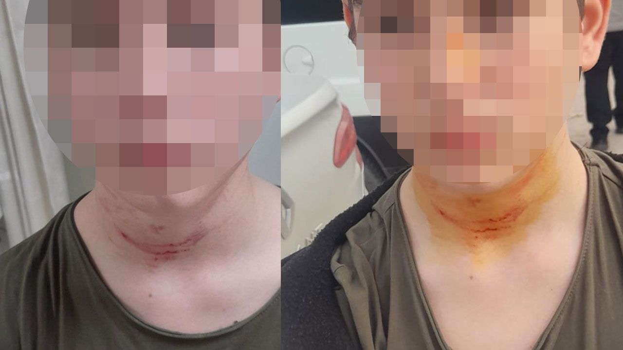 İzmit'te ortaokul öğrencisi dört arkadaşı tarafından ağır darp edildi.